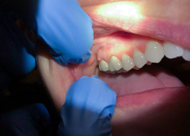 Best Urgent Tooth Repair  in Little Elm, TX