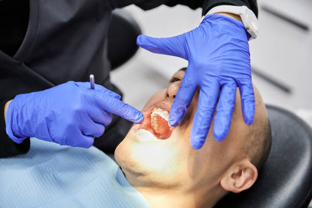 Best Chipped Tooth Repair Near Me  in Little Elm, TX